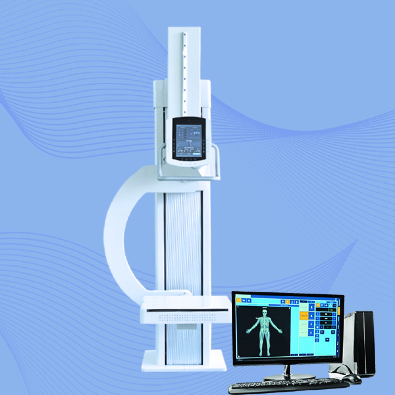 STATIONARY X-RAY SYSTEMS-U-ARM X-RAY SYSTEM
